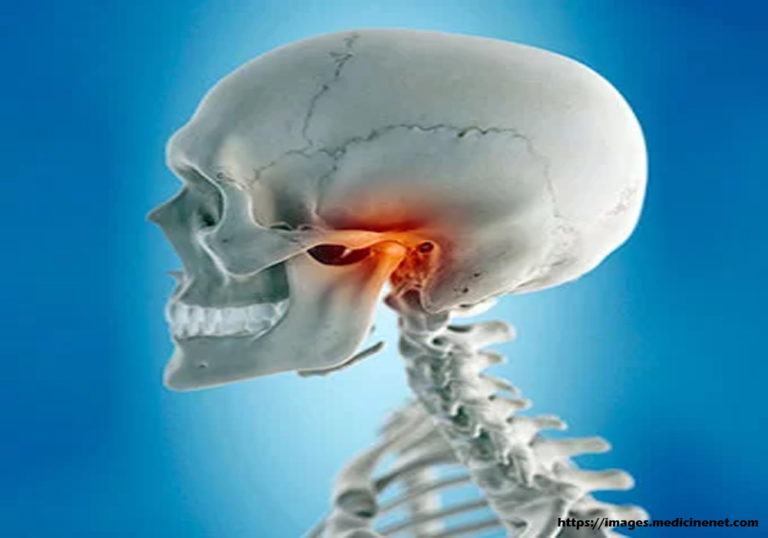 How To Temporarily Treat TMJ Syndrome In The Absence Of A Physician ...